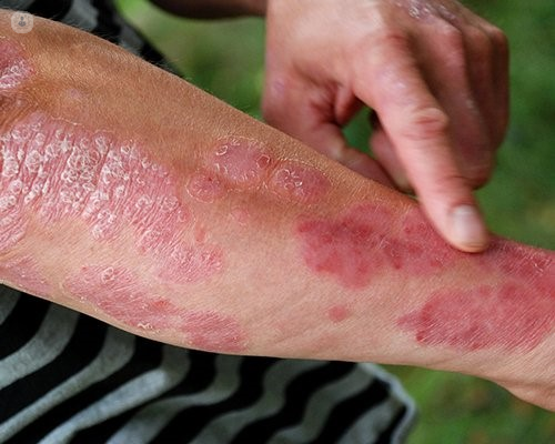 What causes a skin rash? | Top Doctors