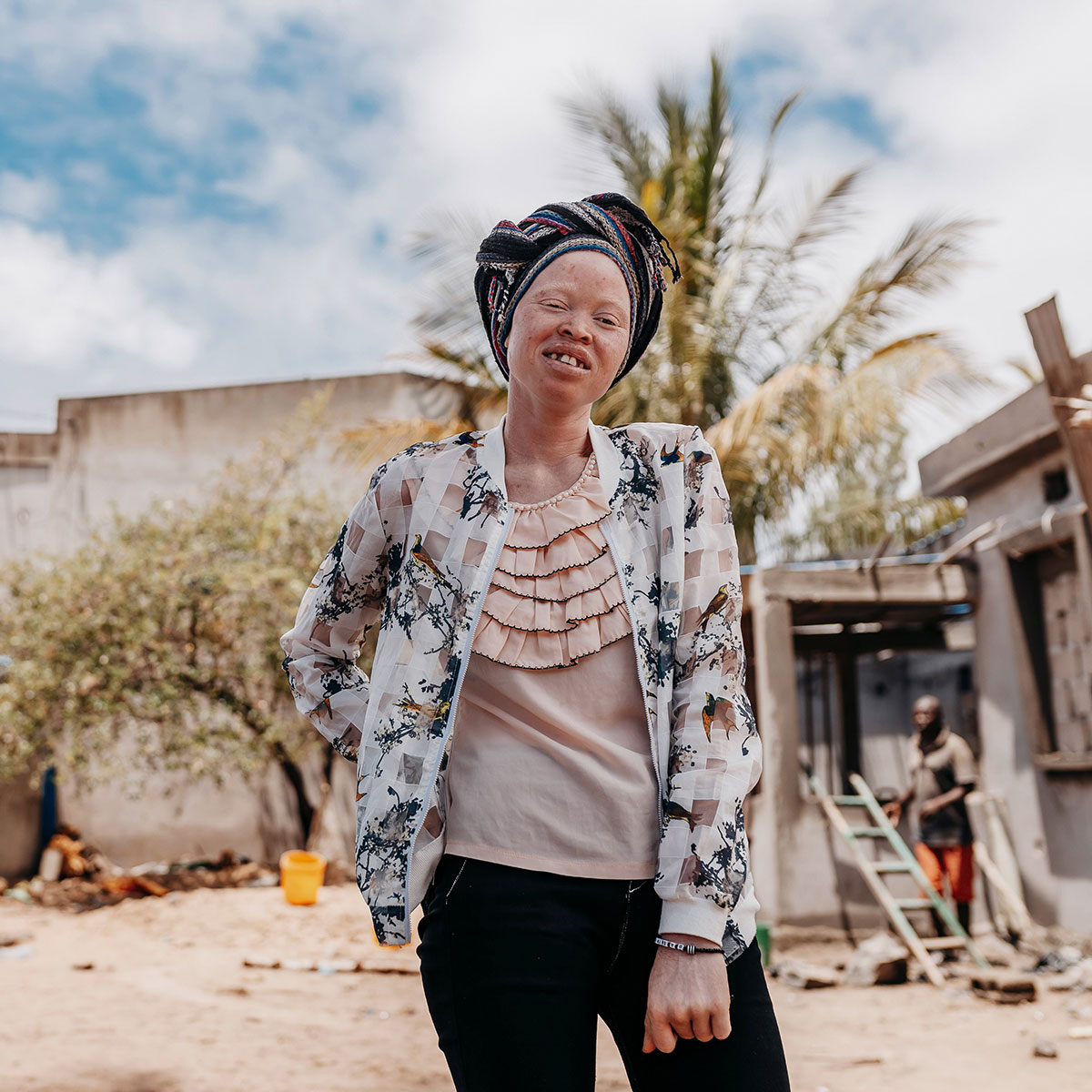 A young woman with albinism stands in a sunny courtyard, squinting against the sun and smiling slightly.