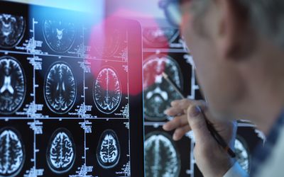 Doctor viewing brain scans in clinic.