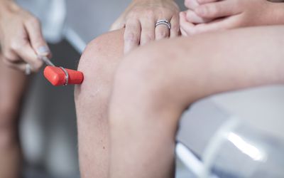 doctor testing child's knee reflexes with rubber hammer